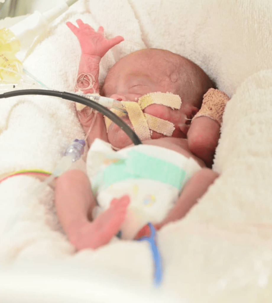 【実際の写真】現在のつむちゃんの様子。（＠futag0papaさんより提供）