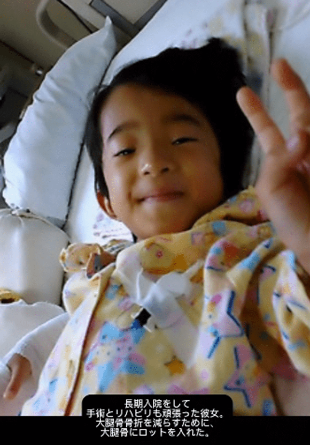 手を振って骨折をしたことも…「人生で約80回以上骨折している」しかし、自身の病を”相棒”と語る女性。そのわけに迫る