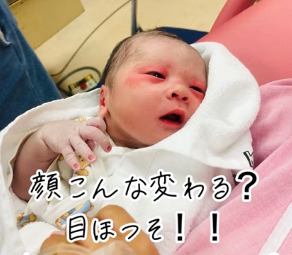 【実際の写真5枚】6ヶ月後の様子（＠imeeeee837さんより提供）