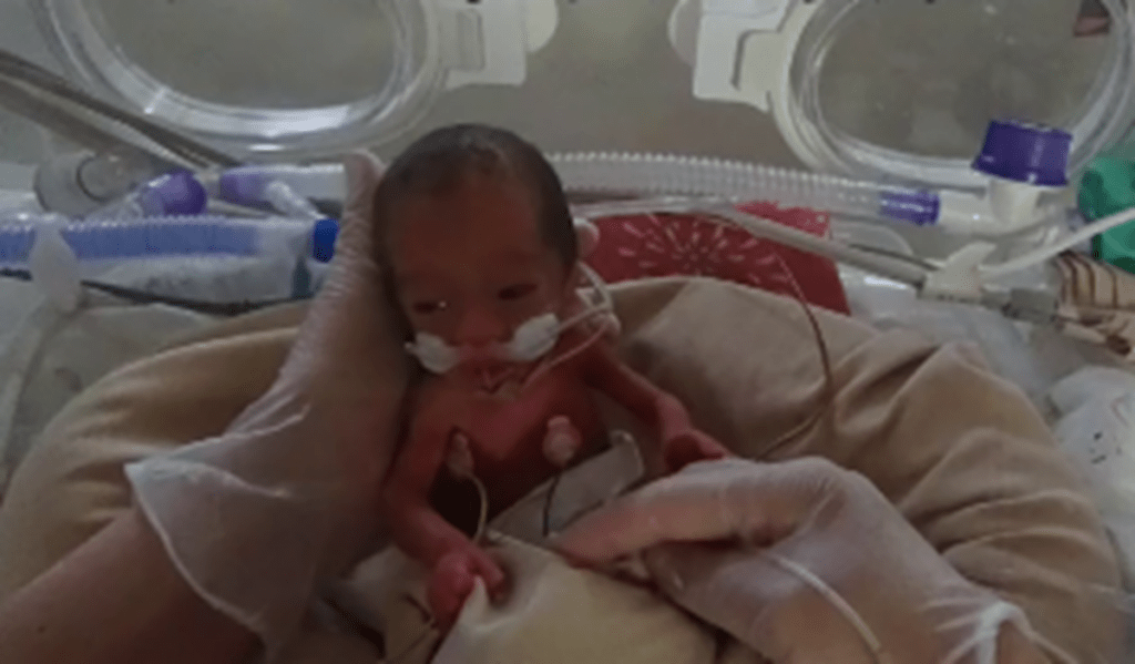 妊娠中…娘に抱いた違和感。その後、医師「足の長さが短く、頭の大きさが小さい」現在の姿と母の思いに迫る