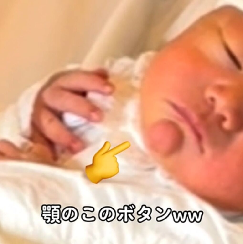 顎にボタンのようなものが…（＠nagibeekunさんより提供）