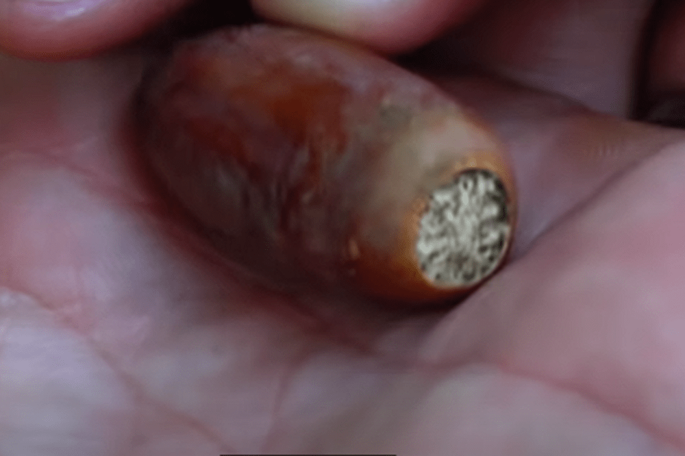 おしりがへこんだ形が特徴のマテバシイ（@chieetonさんより提供）