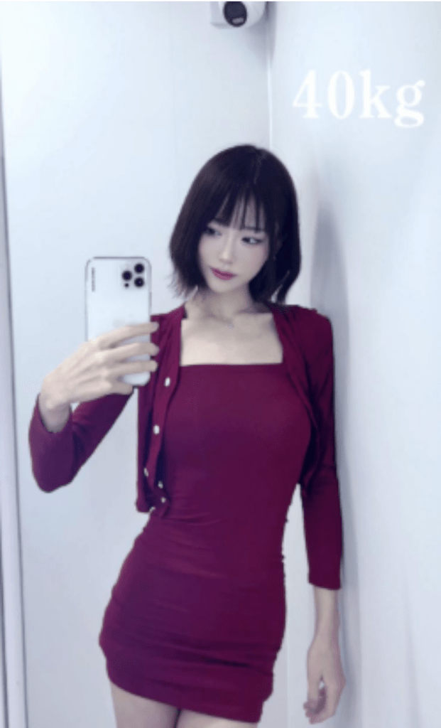 アフター：ワンピース姿（@j14505さんより提供）