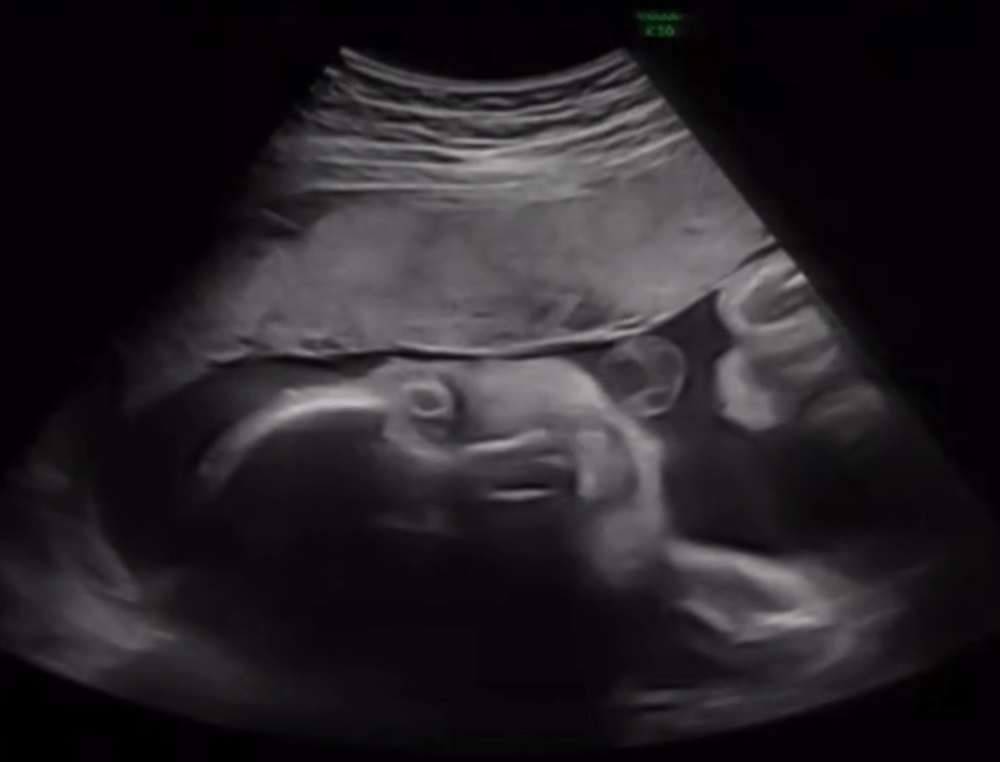 【実際の写真5枚】　母が見た光景