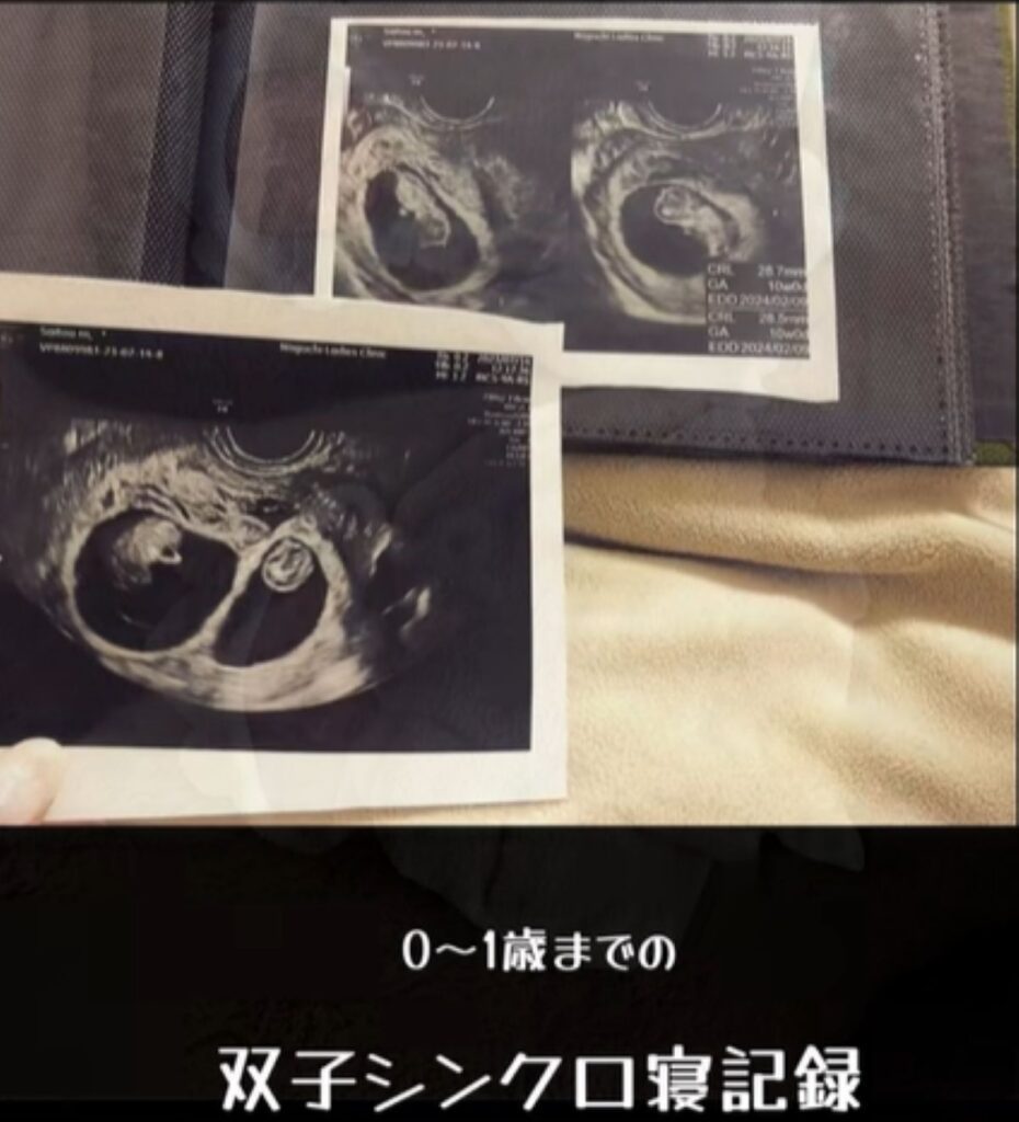 【実際の写真5枚】　1年後の姿