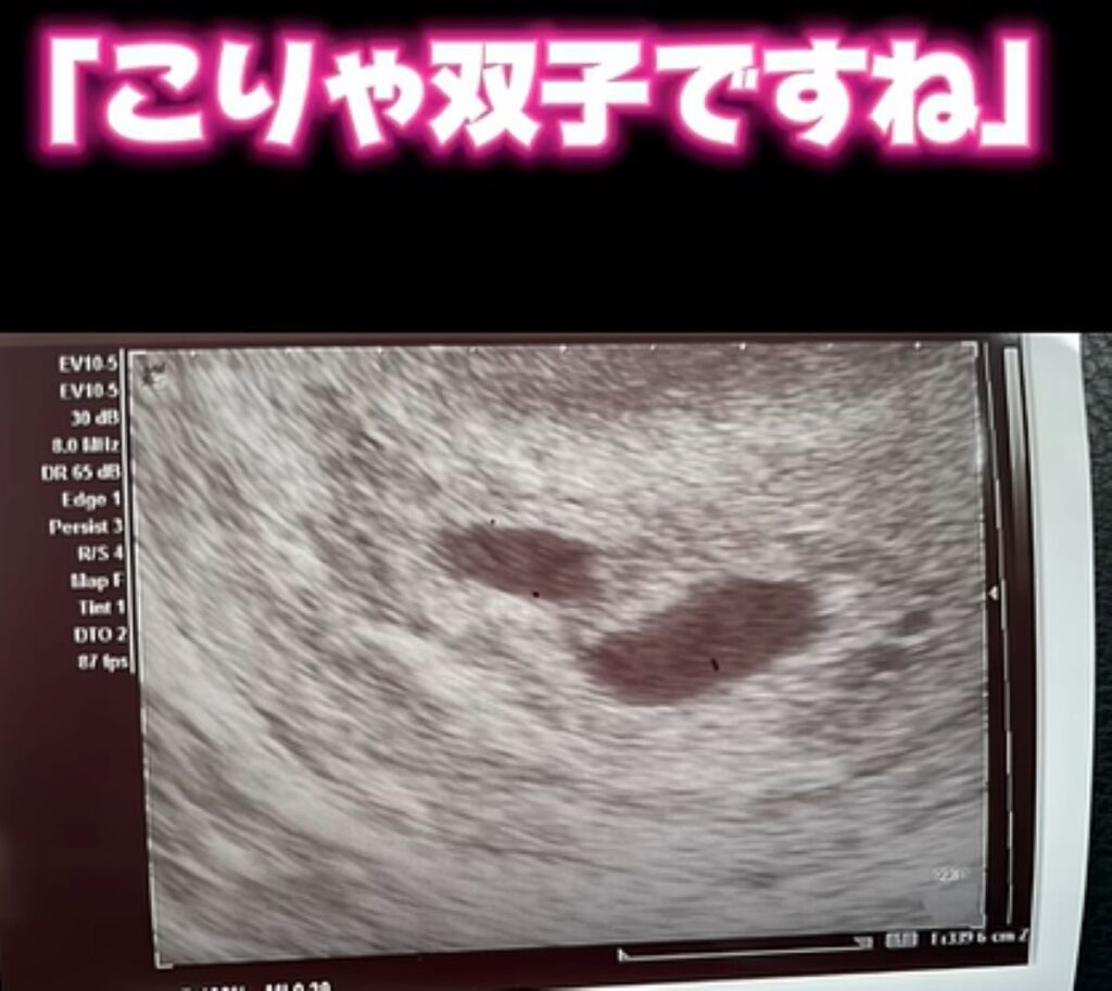 【実際の写真6枚】　エコーの様子