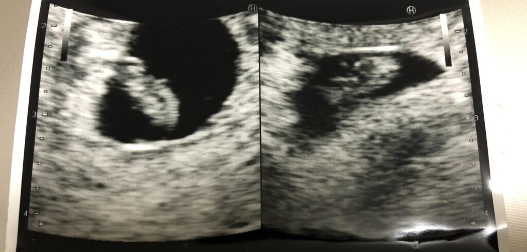 【実際の写真】　ママが見た光景