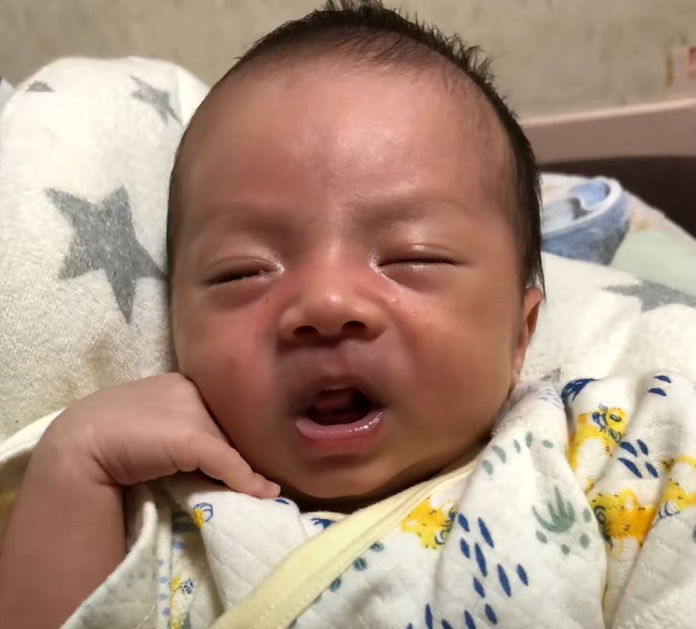 【実際の写真5枚】　１年後の姿