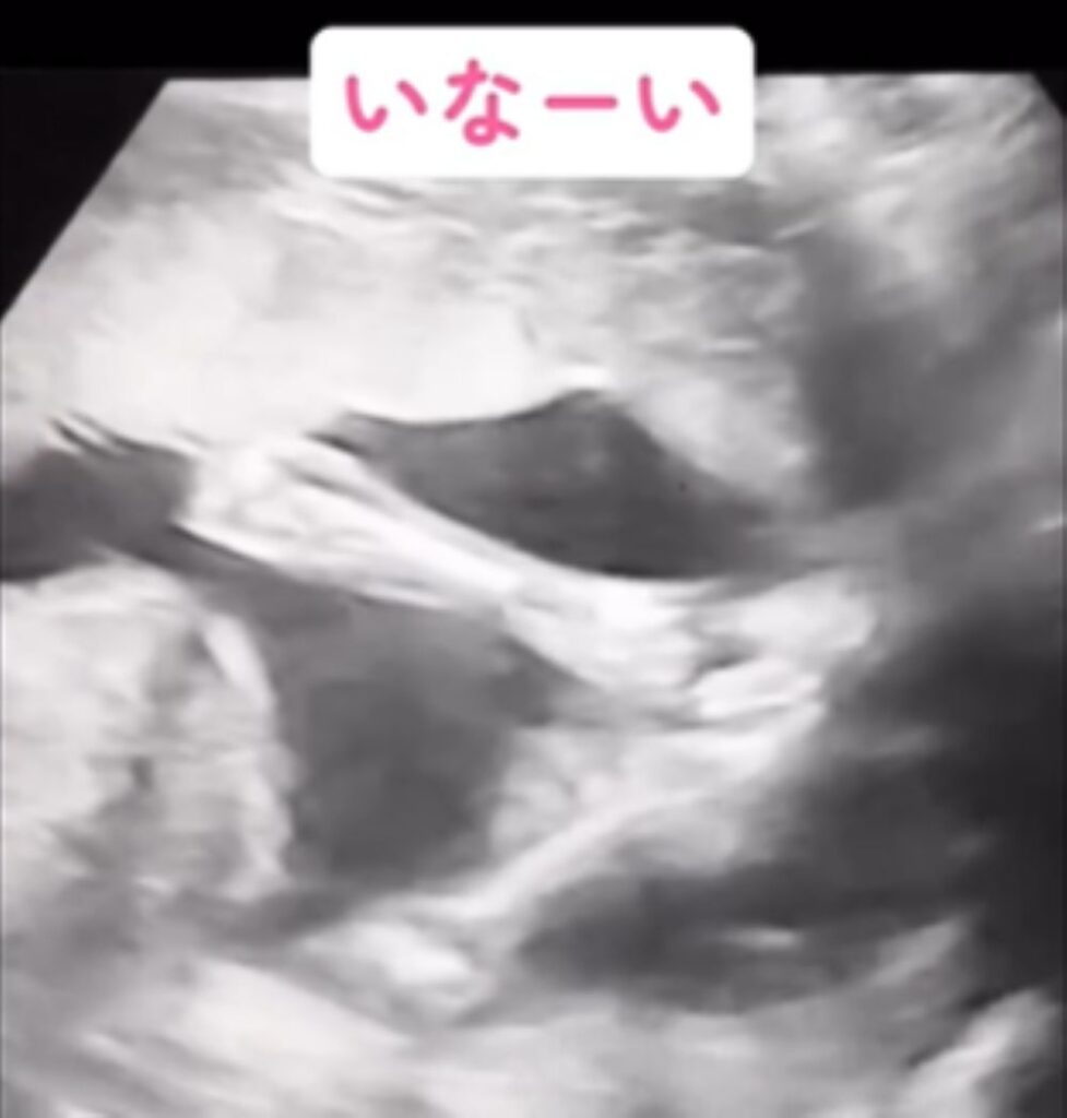 【実際の写真6枚】　ママが見た光景