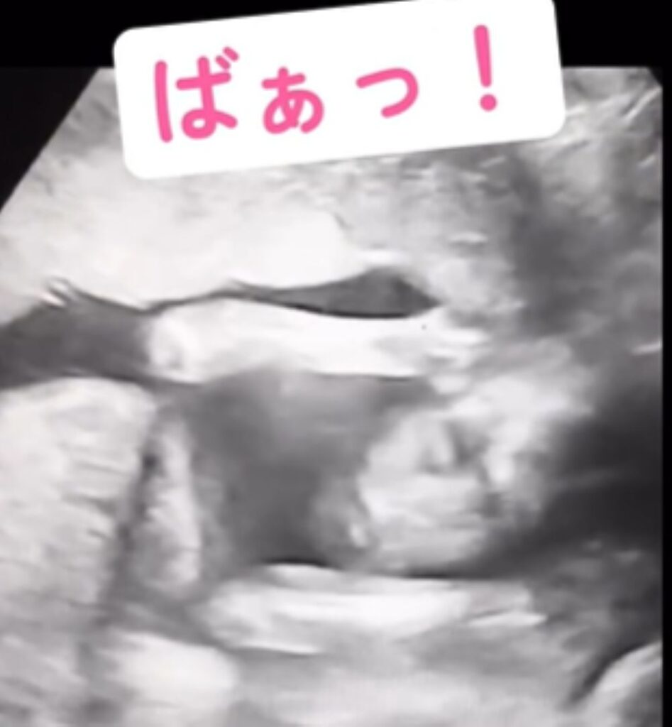ばぁっ！（＠ohana_yuru.ikujiさんより提供）