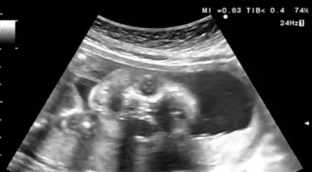 エコー写真①（＠c.ymd_mtさんより提供）