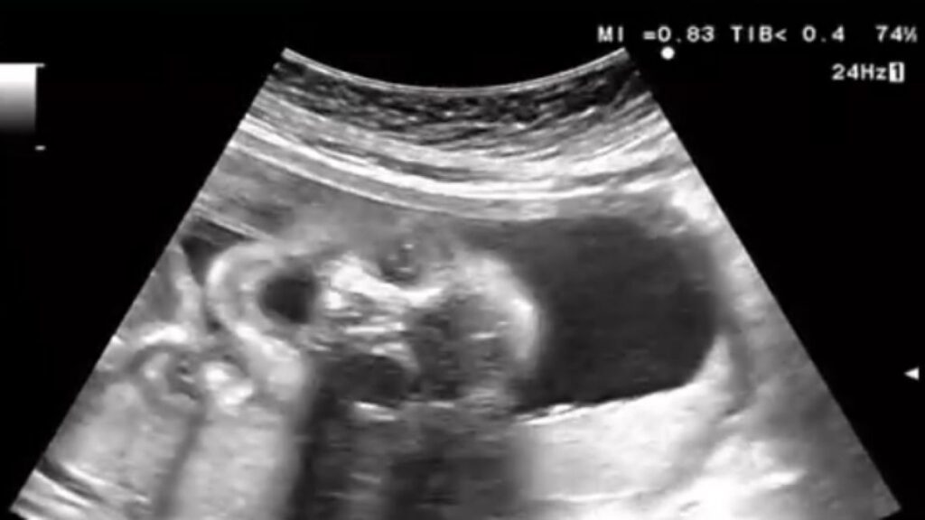 エコー写真②（＠c.ymd_mtさんより提供）