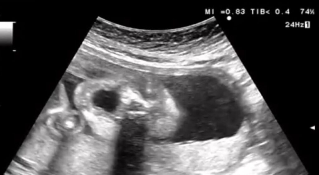 エコー写真③（＠c.ymd_mtさんより提供）