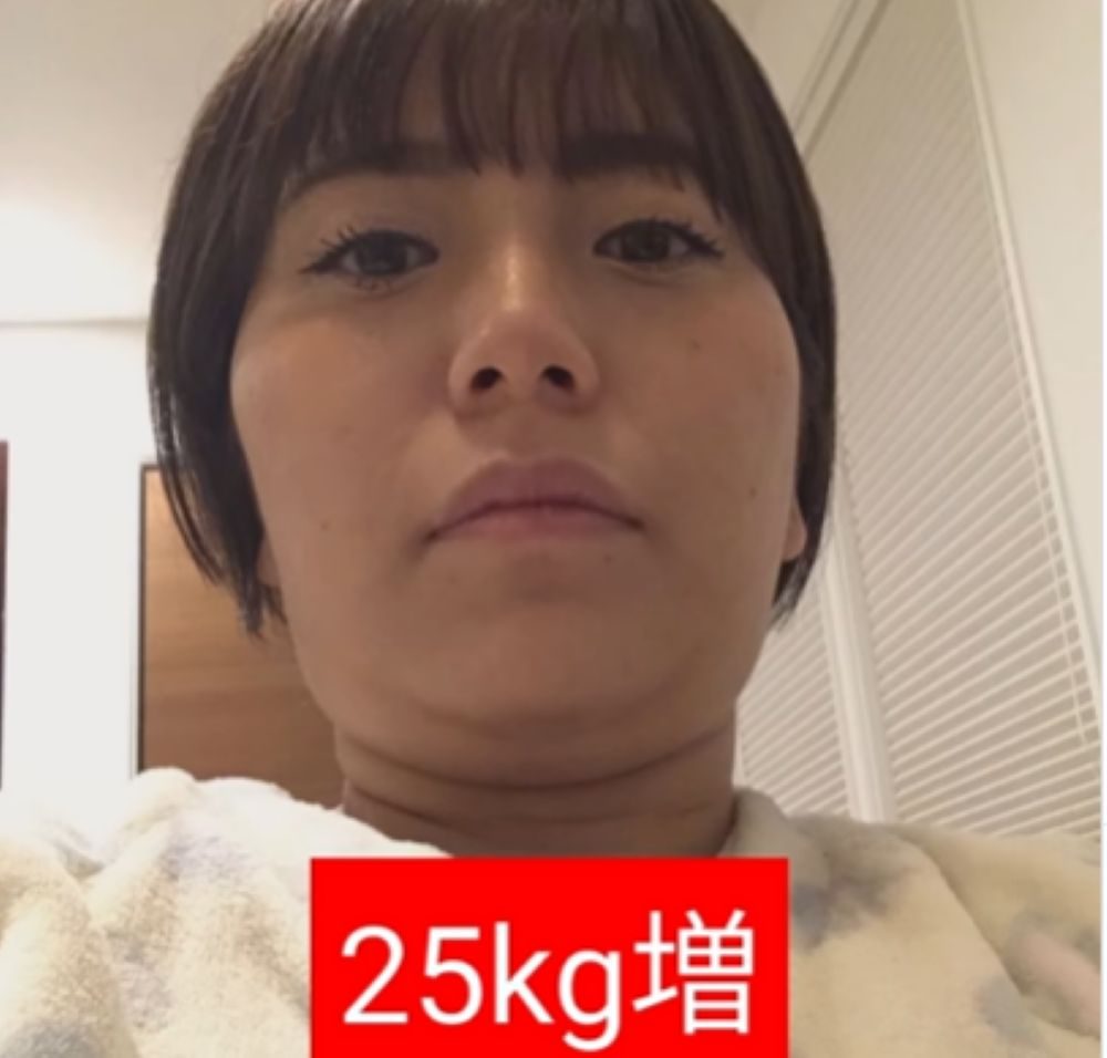 25キロの増加（＠beyan_dietさんより提供）