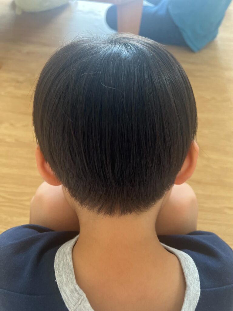 【実際の写真3枚】　７年後の様子