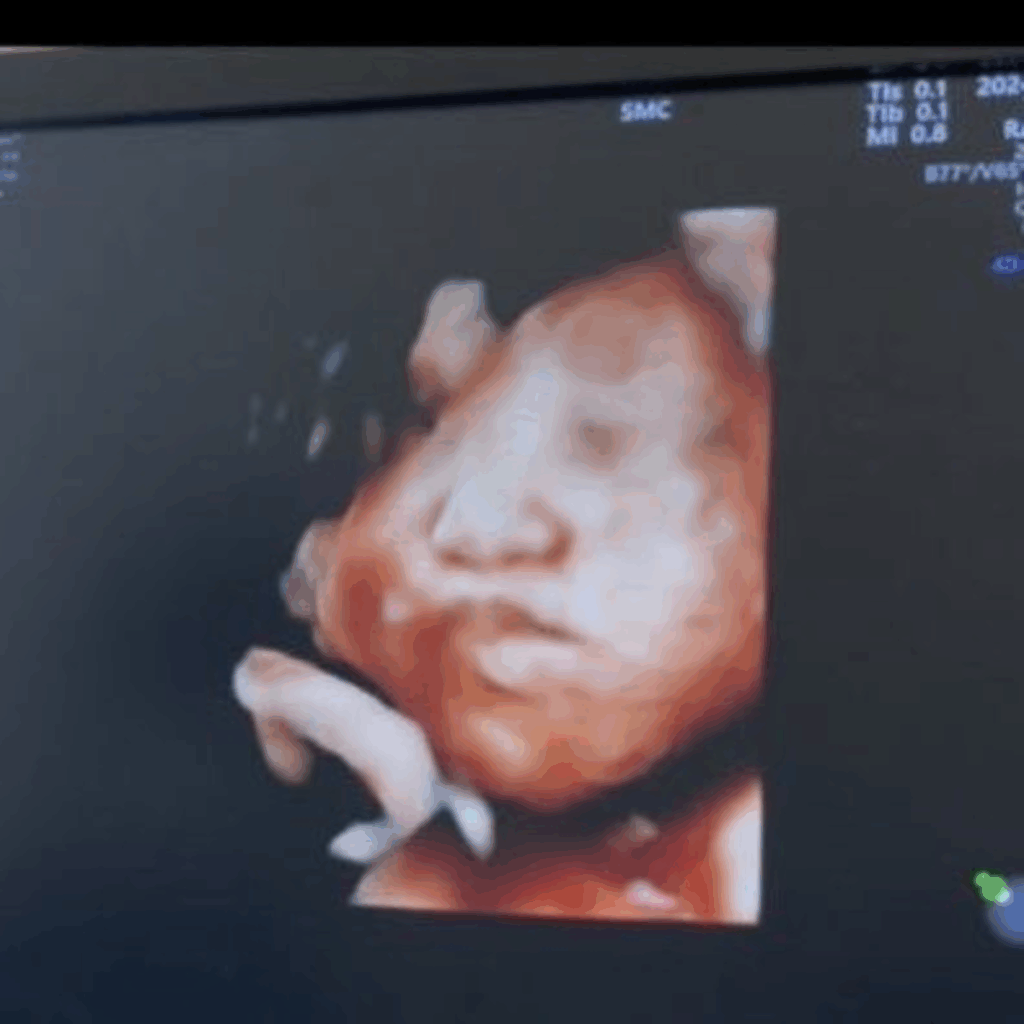 【実際の写真5枚】　ママが見た光景