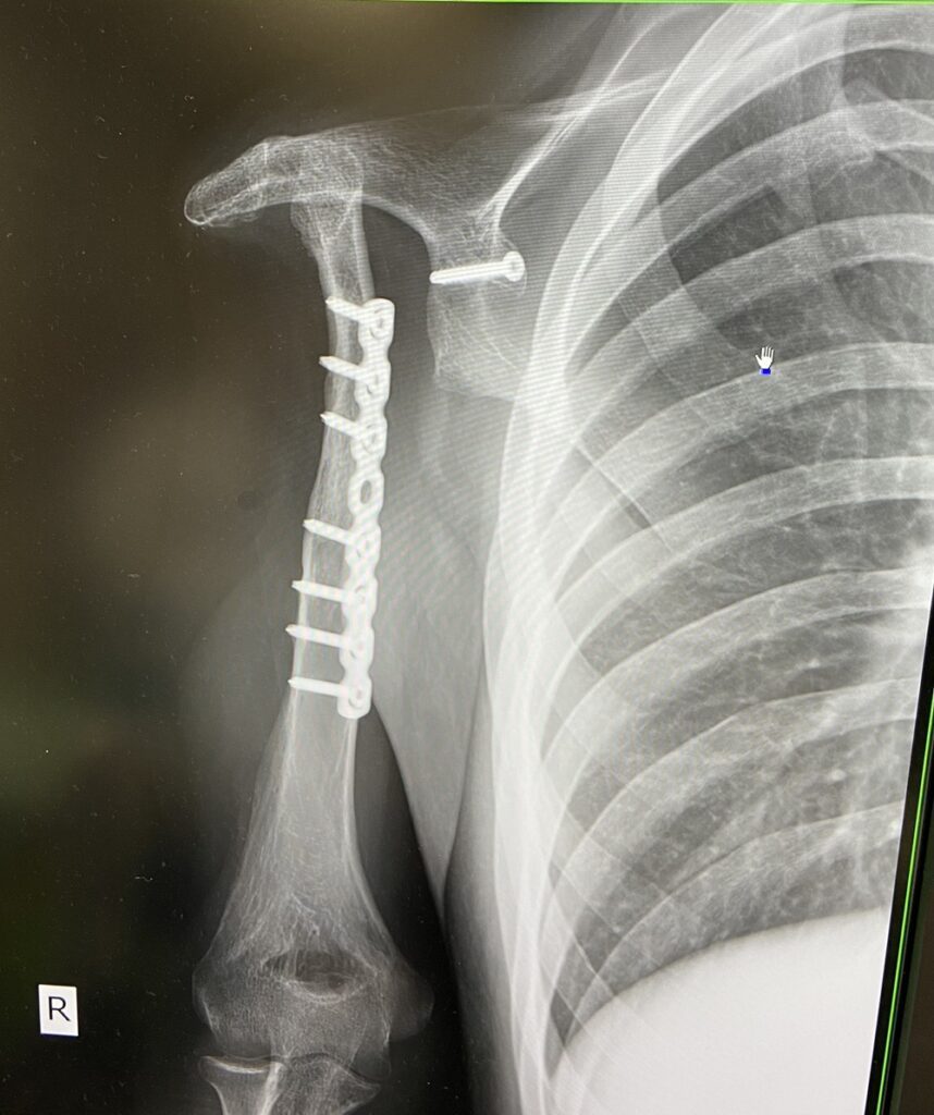 レントゲン写真（@miyabi_udenashiさんより提供）