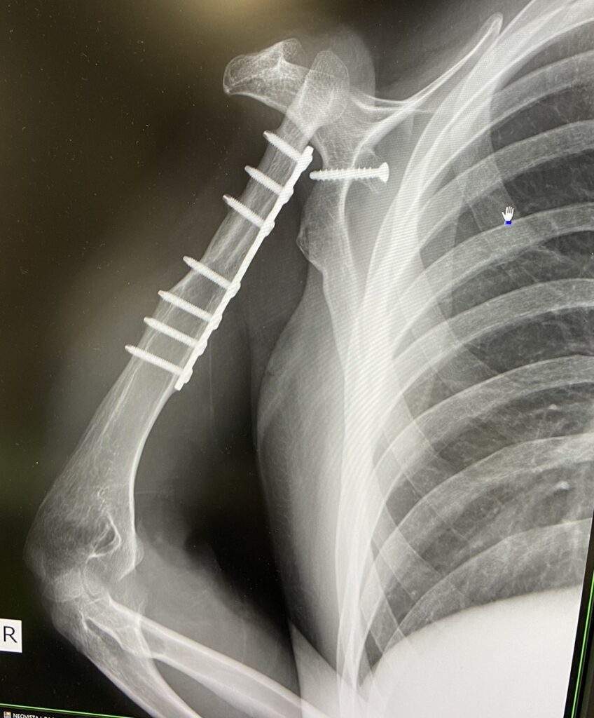 レントゲン写真（@miyabi_udenashiさんより提供）