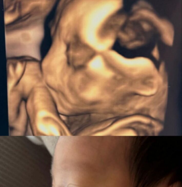 【実際の写真7枚】　その後の様子