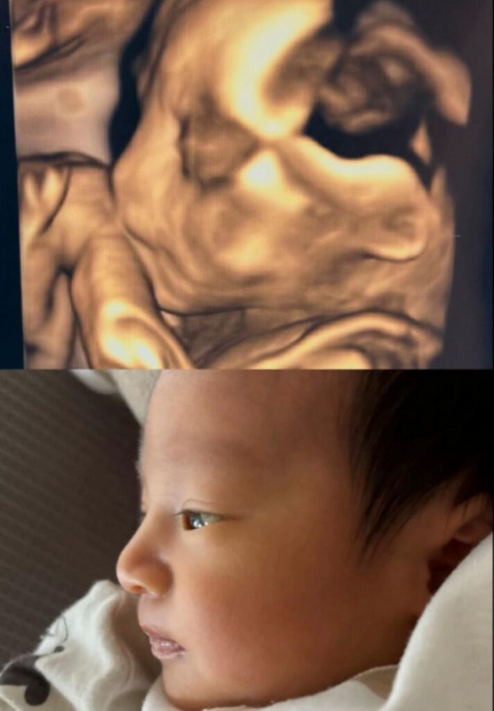 エコー写真と比較すると（＠masamisa2566さんより提供）