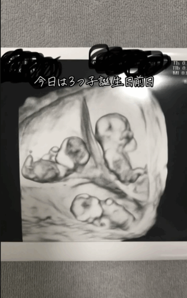 エコー写真（@1.and.triple_mamさんより提供）