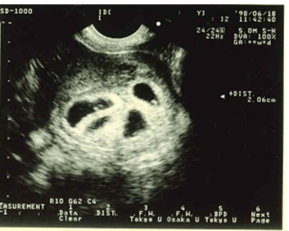 エコー写真（渡邉さんより提供）