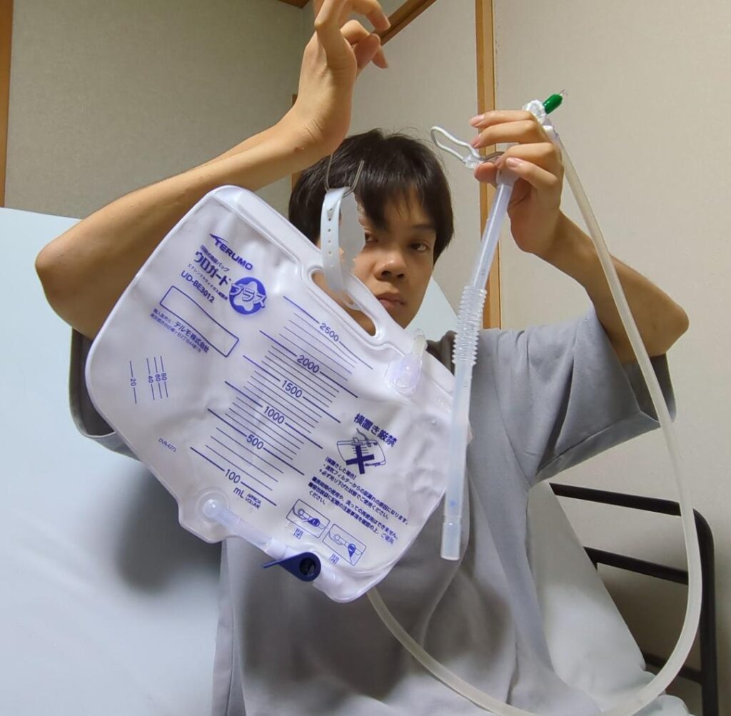 夜間に使用している間欠式バルーンカテーテル（＠keison_travel_wheelchairさんより提供）