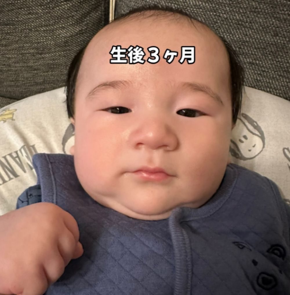 生後3ヶ月の頃（＠ariiiyaaada4.1022bornさんより提供）