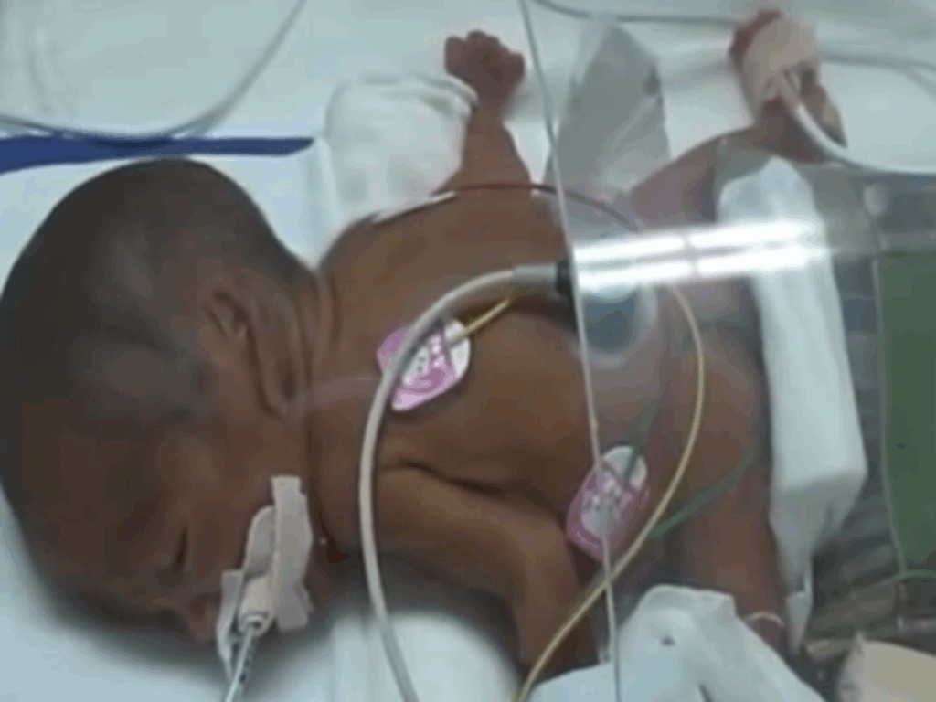 わずか612gで生まれた命の軌跡（＠tetu.momさんより提供）