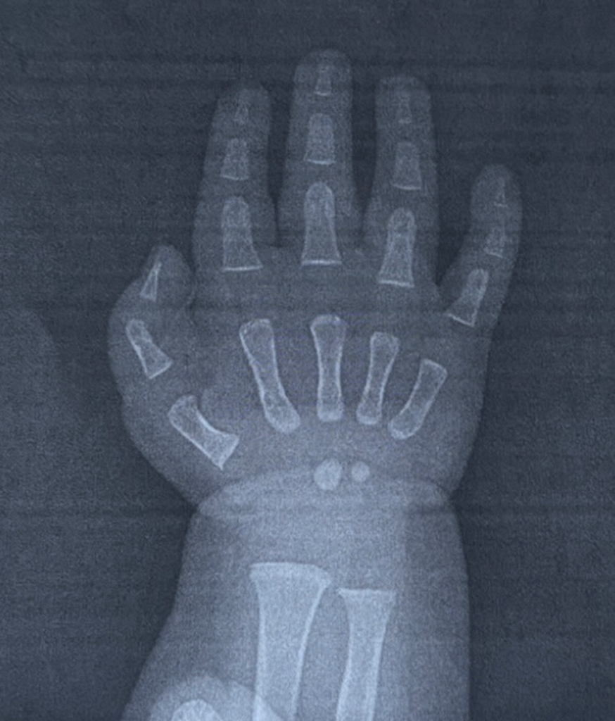 レントゲン写真（＠korekieorganicさんより提供）