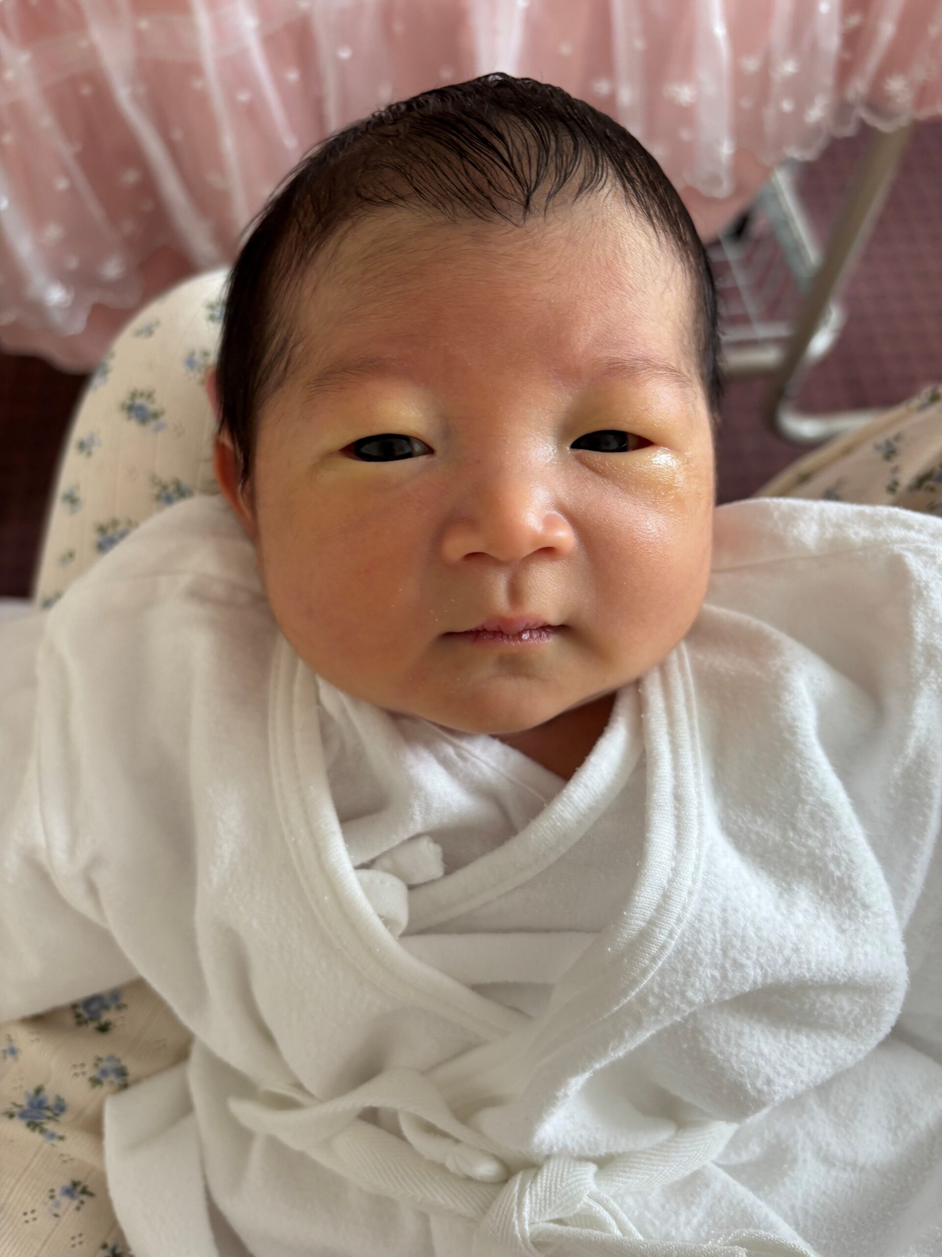 目元のむくみが目立って生まれた赤ちゃん　→しかし、4ヶ月後の姿に「そんなに変わるんですね！？」「いい顔すぎる」「とっても可愛い」