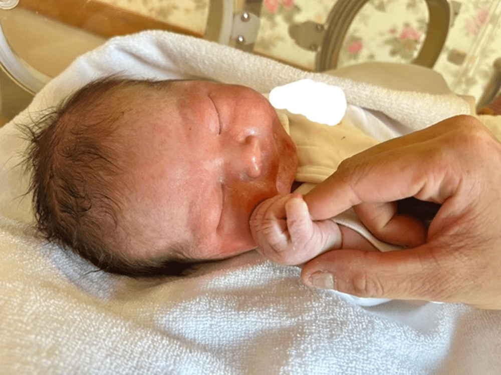 順調だと思っていた出産。　しかし…医師「赤ちゃんの脳室が拡大している」容体が急変した理由とは　現在の様子に迫る