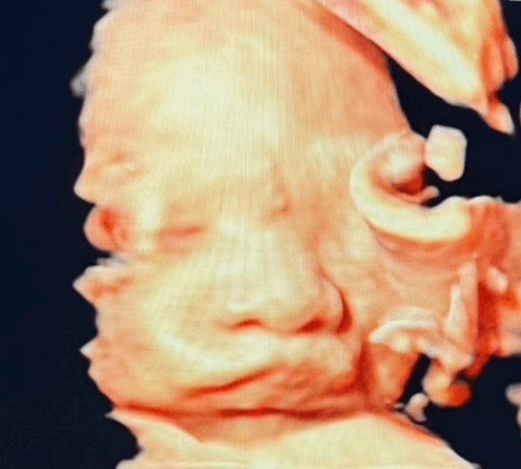 お腹のエコー写真（@harapekochan1さんより提供）