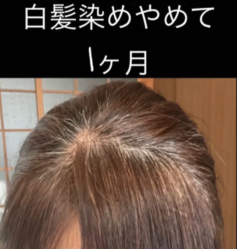 【実際の写真6枚】　３年後の様子