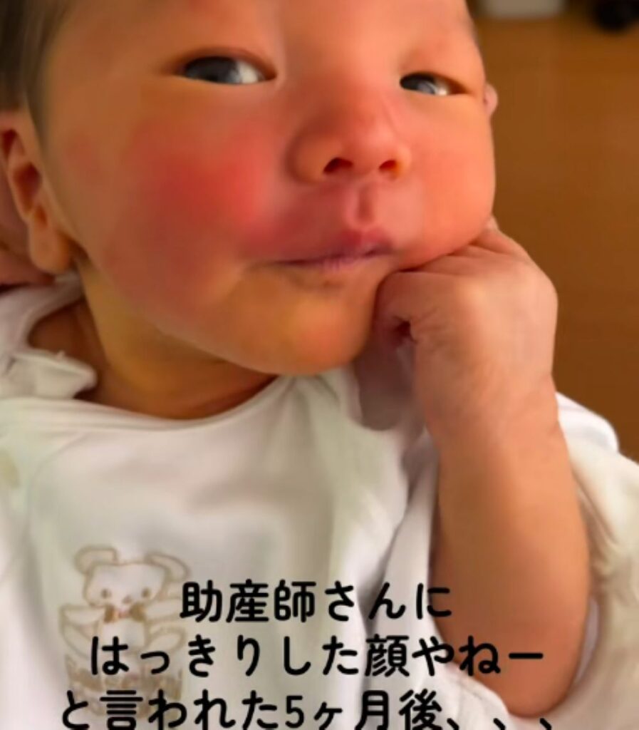 【実際の写真】5ヶ月後の姿