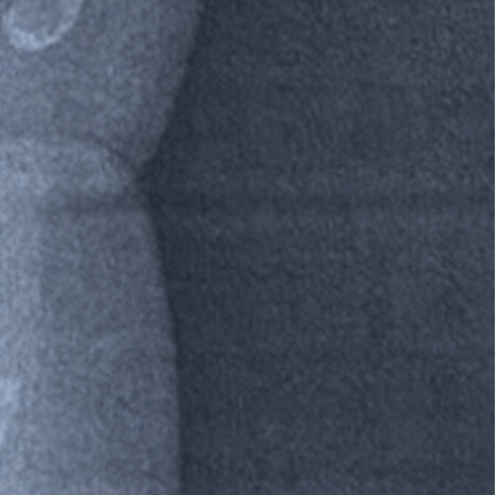 病院でレントゲンを撮った赤ちゃん　よく見ると…そこに写っていた光景に「こんな感情になったのは初めて…！」「めちゃくちゃ可愛い」「ずっと見ちゃう」