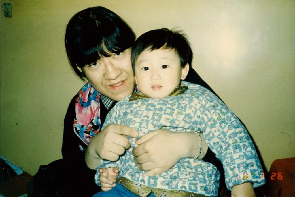 顔が変わった後、手術2ヶ月前（21歳）（山中さんより提供）