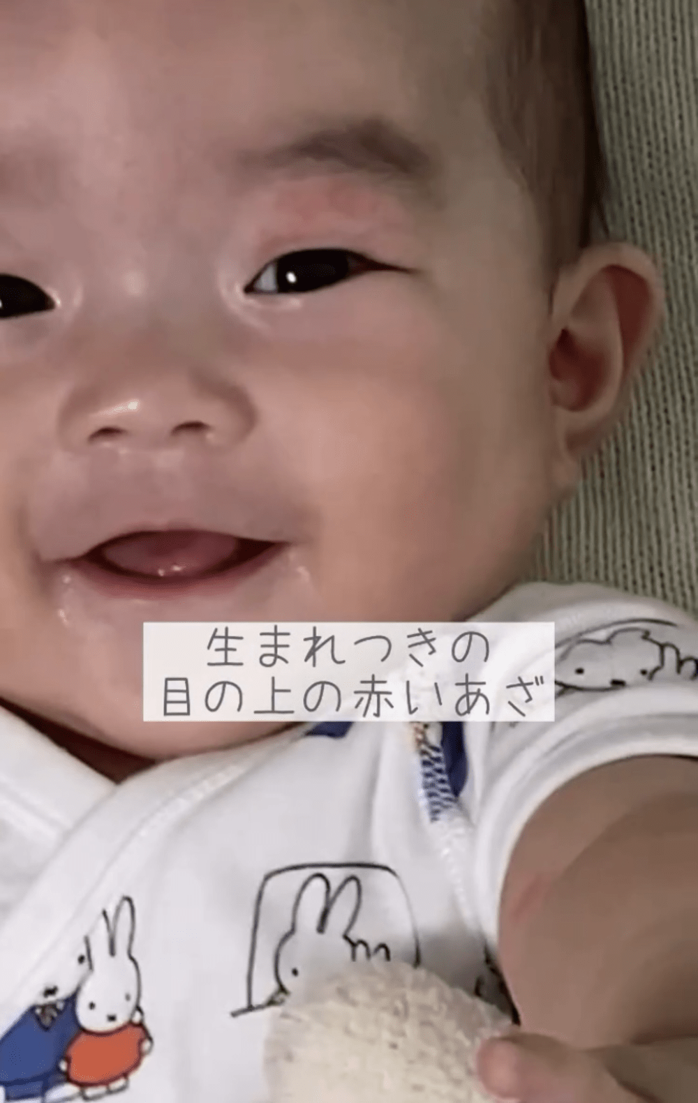 生まれたての娘のまぶたに違和感　医師「アザがありますね」→その後の様子に「愛おしいです」「我が娘にもあります」「いい出会い」