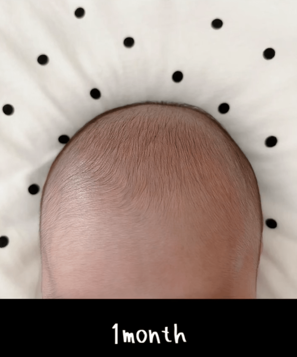 毛量が薄めで生まれてきた赤ちゃん　1年後の様子に「たまらん」「頭の形きれい」「画面から赤ちゃんの匂いが…」