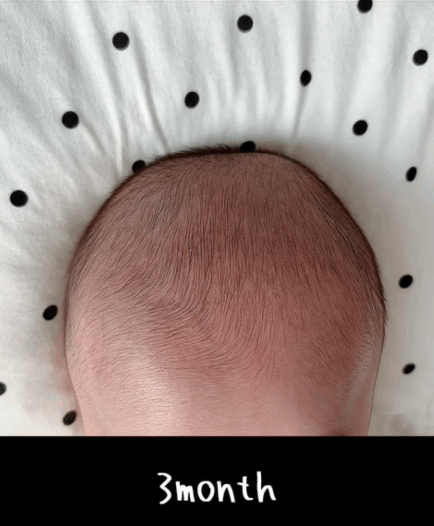生後3ヶ月の髪の毛記録（＠saburo.36さんより提供）