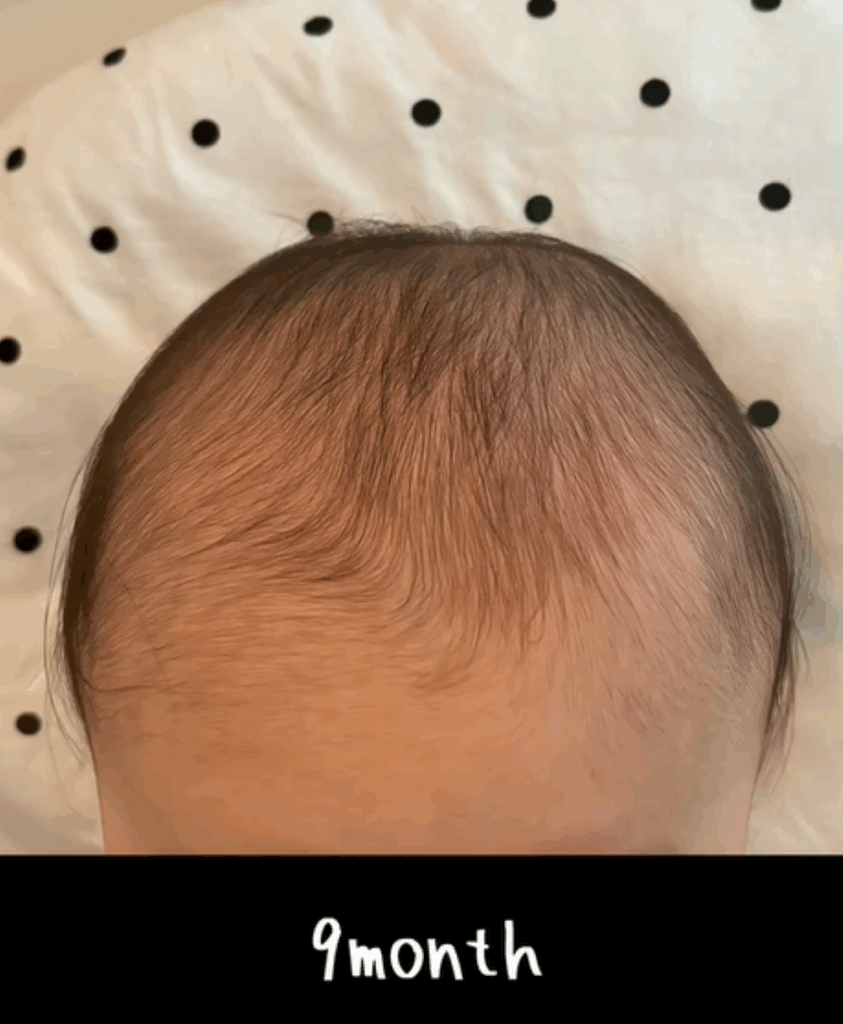 生後9ヶ月の髪の毛記録（＠saburo.36さんより提供）