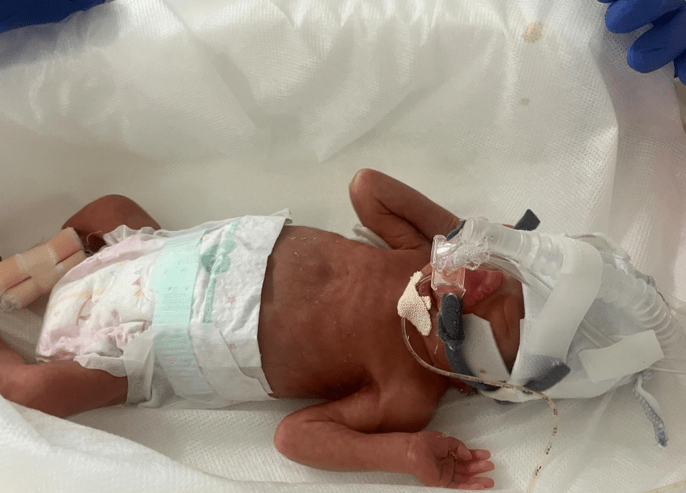 出生時（@natsumi.k_fleelanceさんより提供）