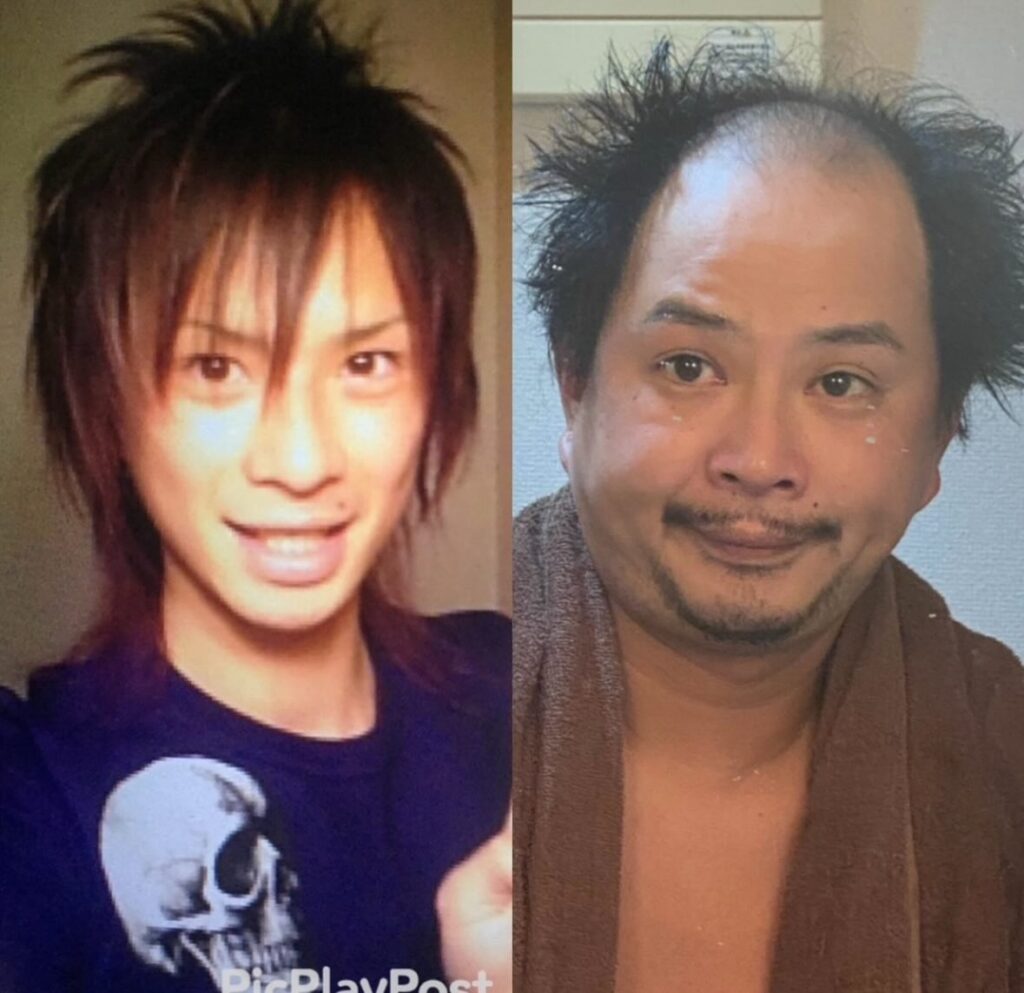 20歳と38歳のときの写真（＠1012.mikiさんより提供）