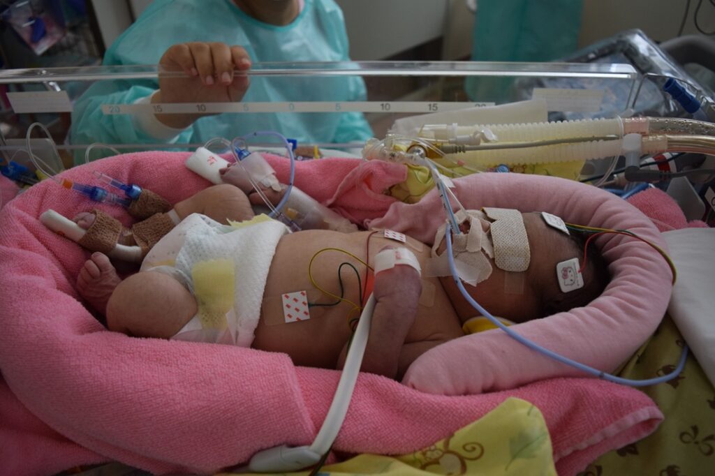 低体温療法中（生後1日）（ミコフォトさんより提供）