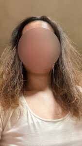 傷んだ髪をリセットするために『坊主』にした女性。7ヶ月後の『衝撃的な姿』に…………「めっちゃきれい」「すごい」