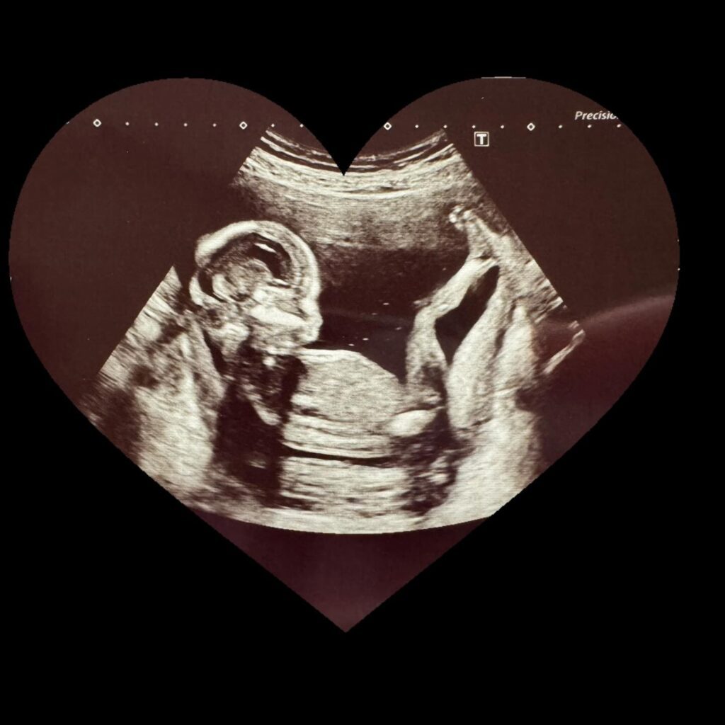 お腹の中でも足上げて…（@sa.matsuiさんより提供）