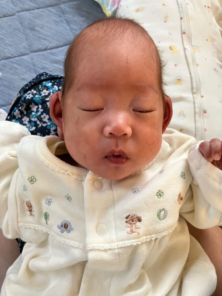 【実際の写真7枚】　1年後の様子