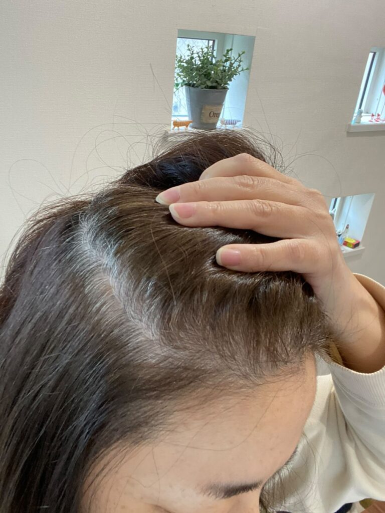 白髪染めをやめて1ヶ月経った頃（＠megumiwa0122さんより提供）