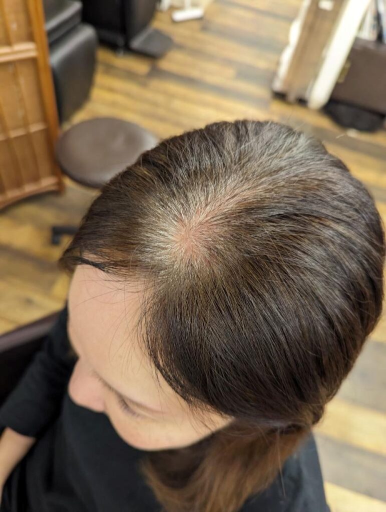 【実際の写真】2年後の姿