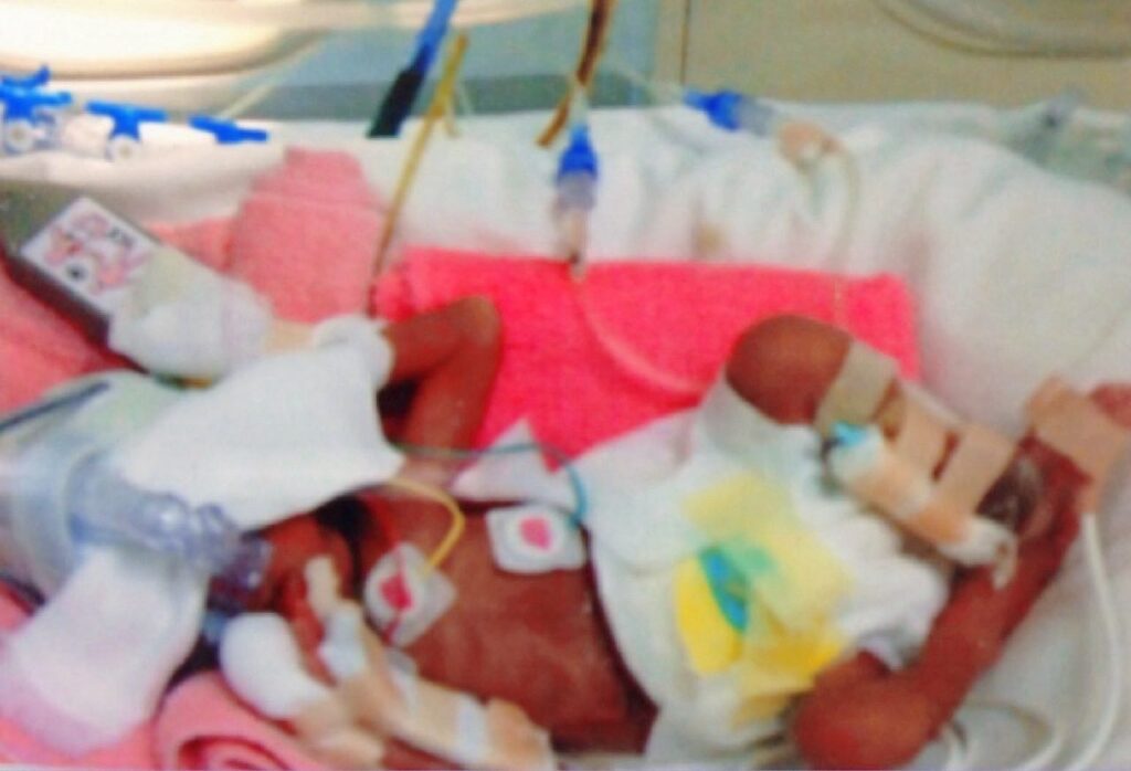 赤ちゃんのとき①（＠twins_donuts_taiyakiさんより提供）